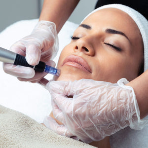 Microneedling